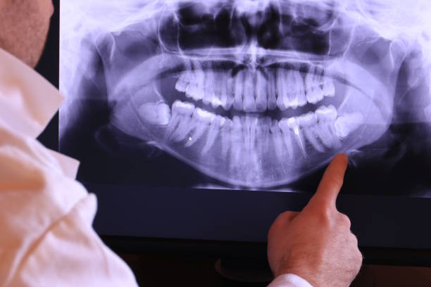 Best Emergency Root Canal Treatment in Goldendale, WA
