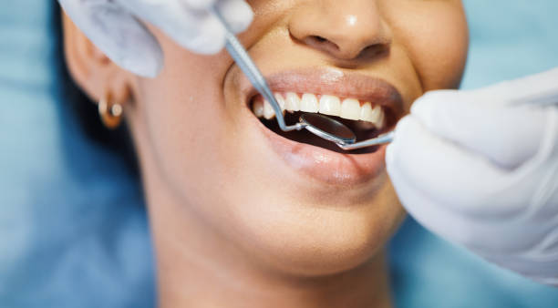 Best Broken or Cracked Tooth Emergency Dentist in Goldendale, WA